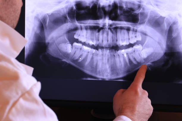 Best Emergency Dental Services for Seniors in Watervliet, NY